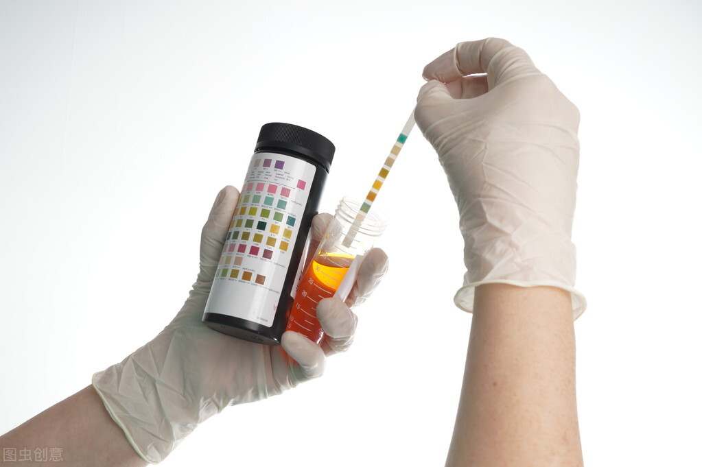 尿蛋白|尿蛋白怎么稳定在正常值?除了吃药外,坚持做好三件事