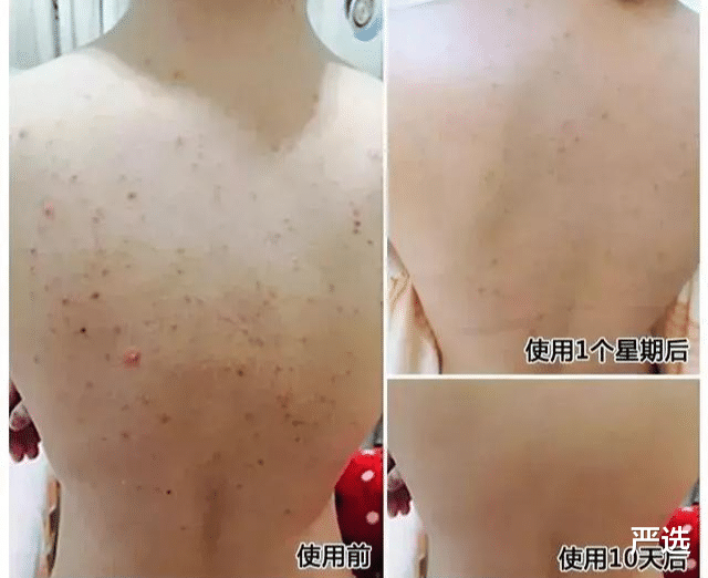 严选|胡可带火的护肤方式！陈数：用了5年，孙俪：美白祛黑头不输大牌