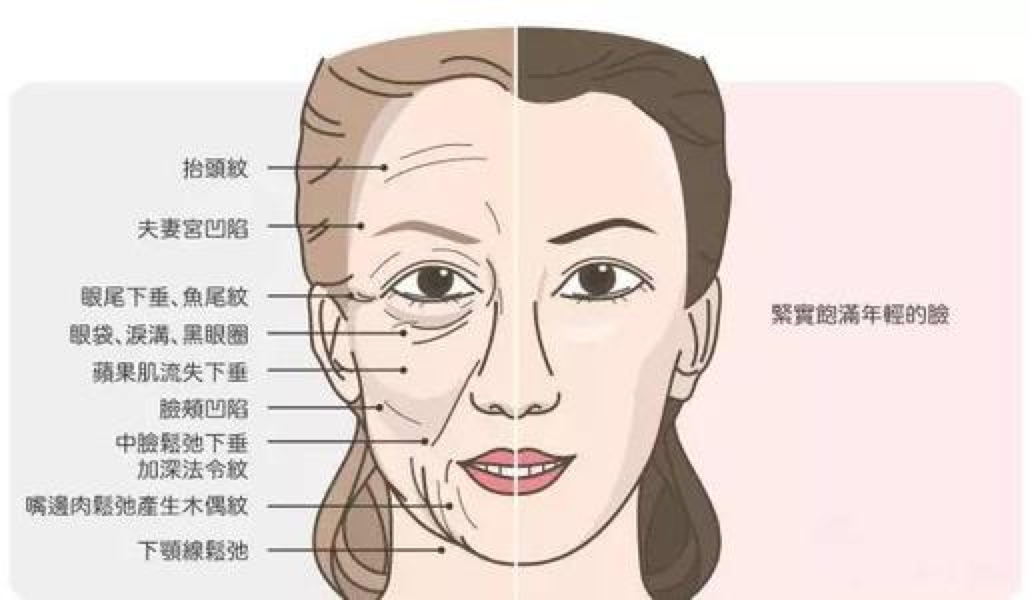 珑阳谈护肤 淡化法令纹的办法有哪些？哪些是真的有效的？