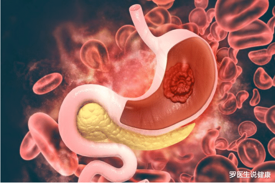 蛋白质|吃一口相当于十斤南瓜，消化科医生：若你爱吃，杀菌消炎，胃渐渐恢复健康