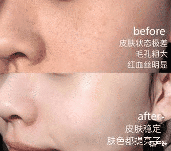 王鸥|王鸥不小心晒出的面膜, 却因价格太低被无视, 网友: 3次白的像牛奶!