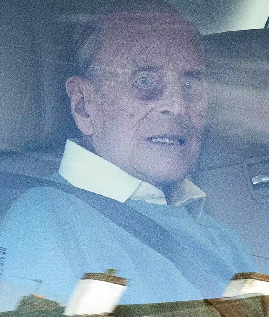 99歲菲利普親王因病住院！眼眶深凹瘦成皮包骨，“蜥蜴肌膚”嚇人-圖4
