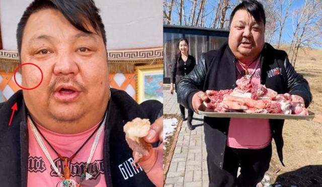 恩克脸上红肉呈“鸡血”状态,直播昏睡无人理,网友:救救他吧