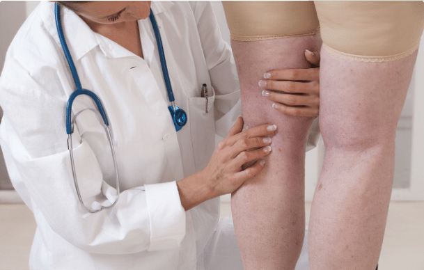 肾衰竭|解除肾衰竭威胁的方法，肾友须知：保肾还需“三步走”