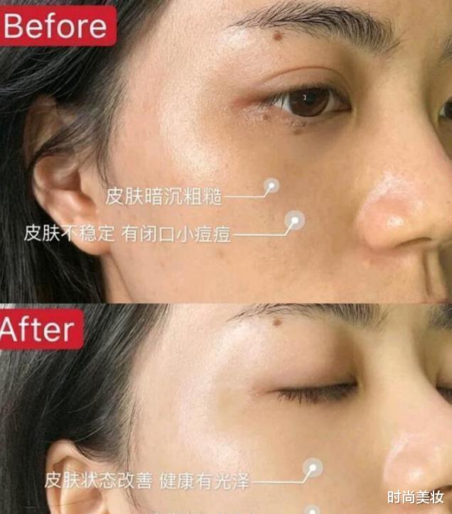 补水|刚洗完脸就涂精华液？难怪效果不佳还浪费，教你正确的精华液用法