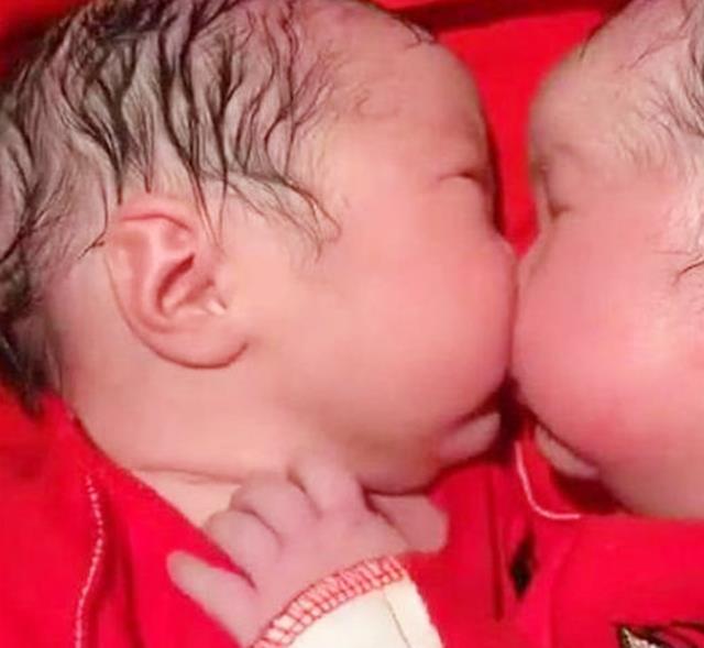 西红柿妈谈育|双胞胎姐妹出生15分钟，妹妹对姐姐这个动作，把在场很多人感动了