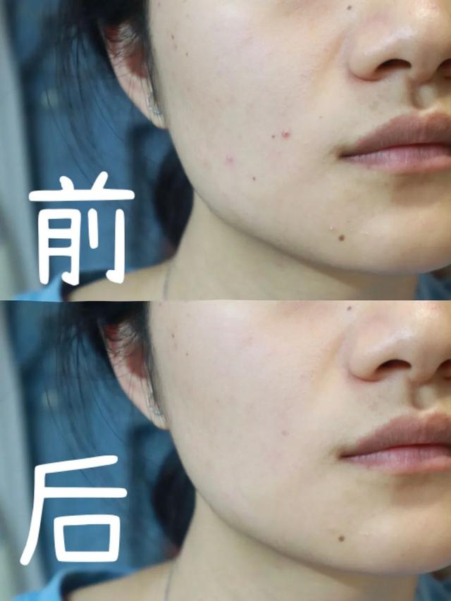 穿衣搭配 让一让让一让，杨幂同款少女感不能没有它