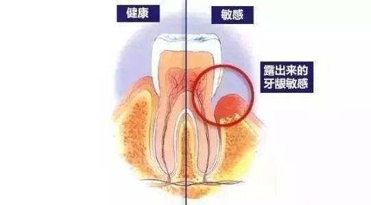 口腔大讲堂|电动牙刷哪个牌子好？牙医3000字干货教你如何选择电动牙刷