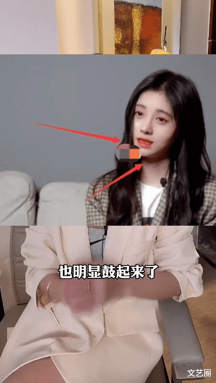 鞠婧祎|网红整容痕迹明显却吐槽鞠婧祎有整容后遗症，被网友打脸后坦言：我动过全脸