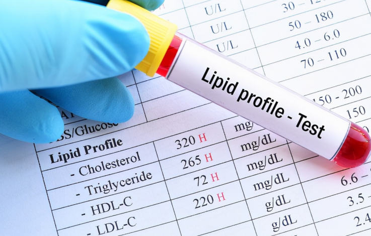 肝脏|卫生组织呼吁：停止食用一“调料”，或正挖空你的肝脏，提醒父母撤下餐桌