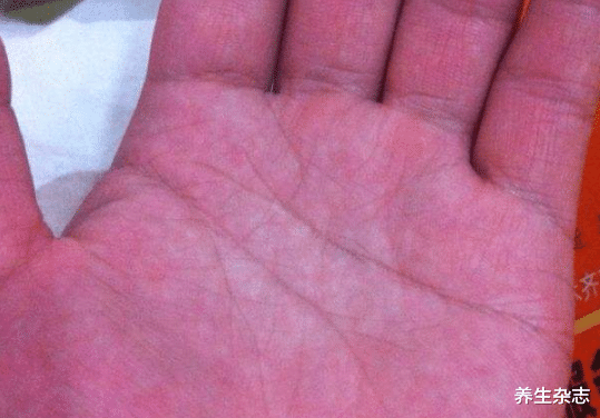 肝脏|55岁大叔滴酒不沾,却查出肝癌,医生叹息:只因平时妻子太节俭