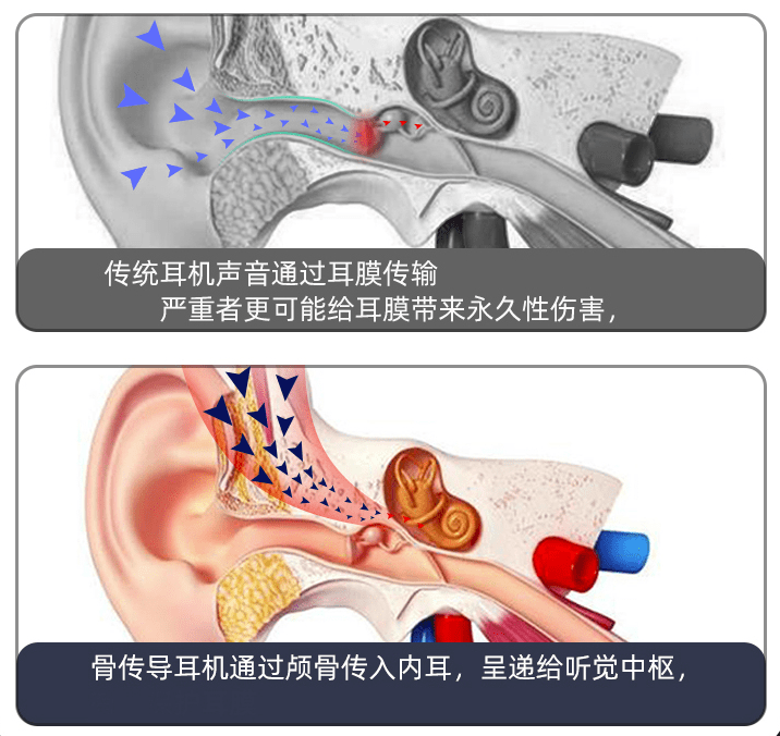 小米科技|怎么减少耳机对耳朵的危害呢？丁香医生给出了答案！