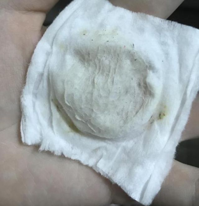 护肤|宋智孝为美“全身换血”护肤升级后皮肤更好，38岁看着像18岁少女