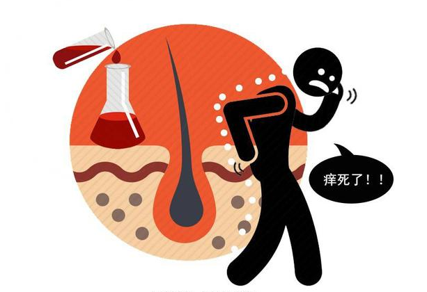 尿毒症|尿毒症并非静悄悄，上半身3个部位露出破绽，可惜很多人没看懂