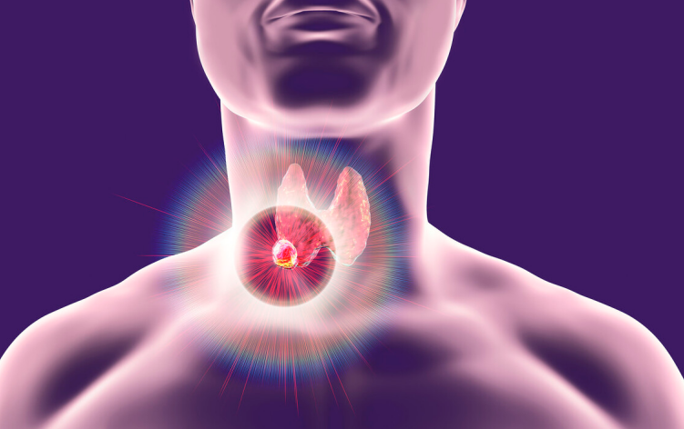 甲状腺|睡觉若有3种异常，多半甲状腺已癌变，若占一种，也要及时检查