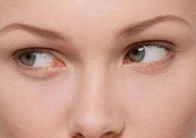 脑出血|血压高的人,“头部”出现4异常,多半是脑出血,最好检查一下脑CT