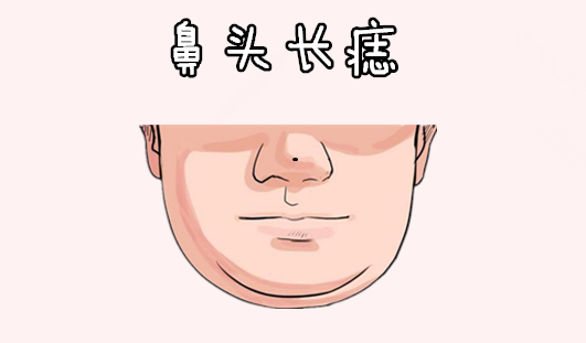 中国易经风水|身上5颗“黄金”痣，颗颗值千金，个个藏富贵，一个比一个值钱！