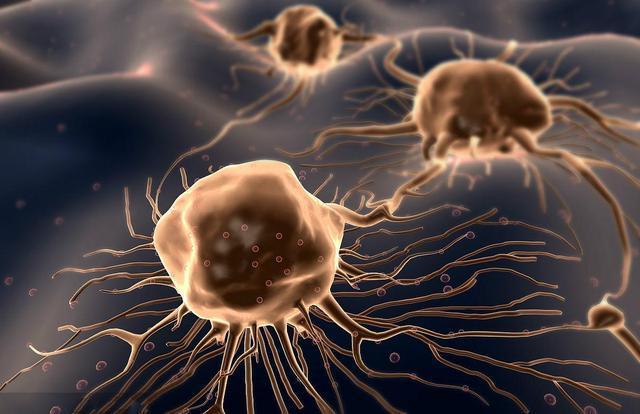 熬夜|全球1/6癌症由它引发！国际癌症研究所：2大慢性炎症要及早治