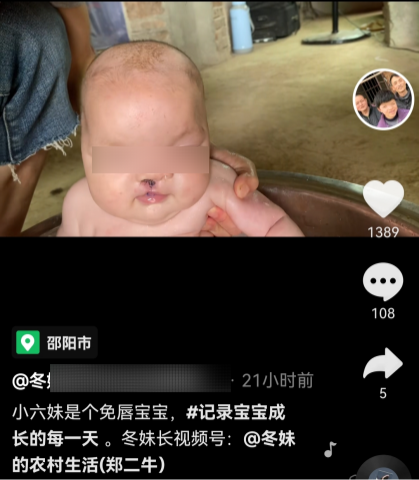 育儿宝屋|我有遗传病但坚持生了五胎：一个白化病、一个唇腭裂、一个精神病