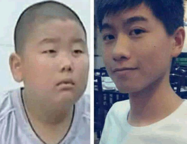 张歆艺|有种“整容”叫《巴啦啦小魔仙》石小龙，因胖被嫌丑，今判若两人