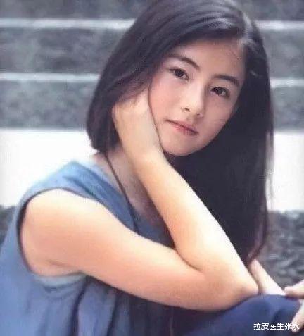 张柏芝|面部折叠度高的明星有哪些？