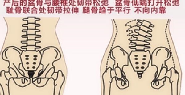 赵丽颖|赵丽颖录综艺被吐槽矫情，看到她床上的骨盆正骨器，宝妈感同身受