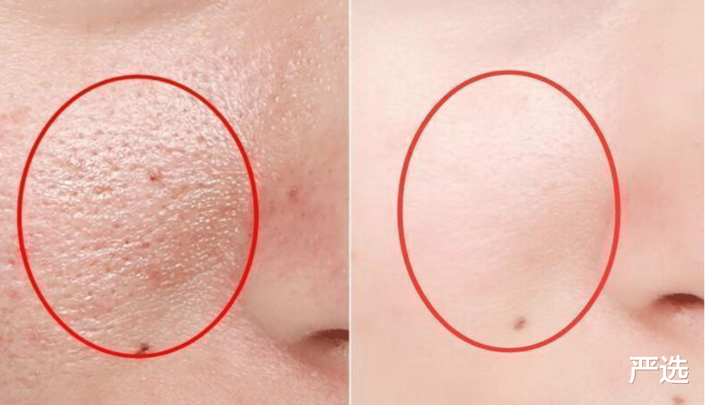 护肤品 中国的“尴尬”护肤品,因包装太土被忽视,却是不输兰蔻的良心货