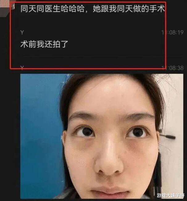 孙一宁|孙一宁的报应来了，无美颜照片刚被喷太丑，整容前的模样又被曝光