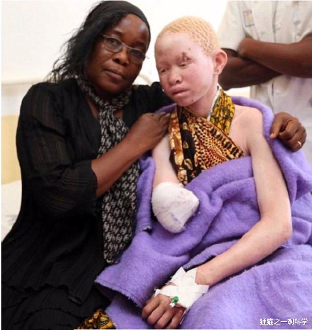 虎鲸 动物也会歧视肤色吗？日本发现白色虎鲸，浑身都是同类咬的伤口