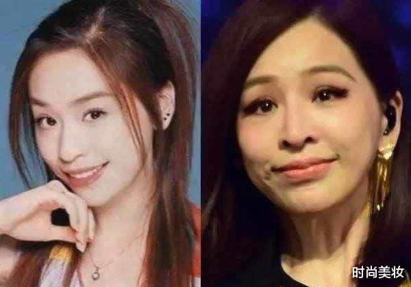 护肤|张嘉倪从小煤球变白灯泡，只要护肤方式选得好，完全不要靠美白针