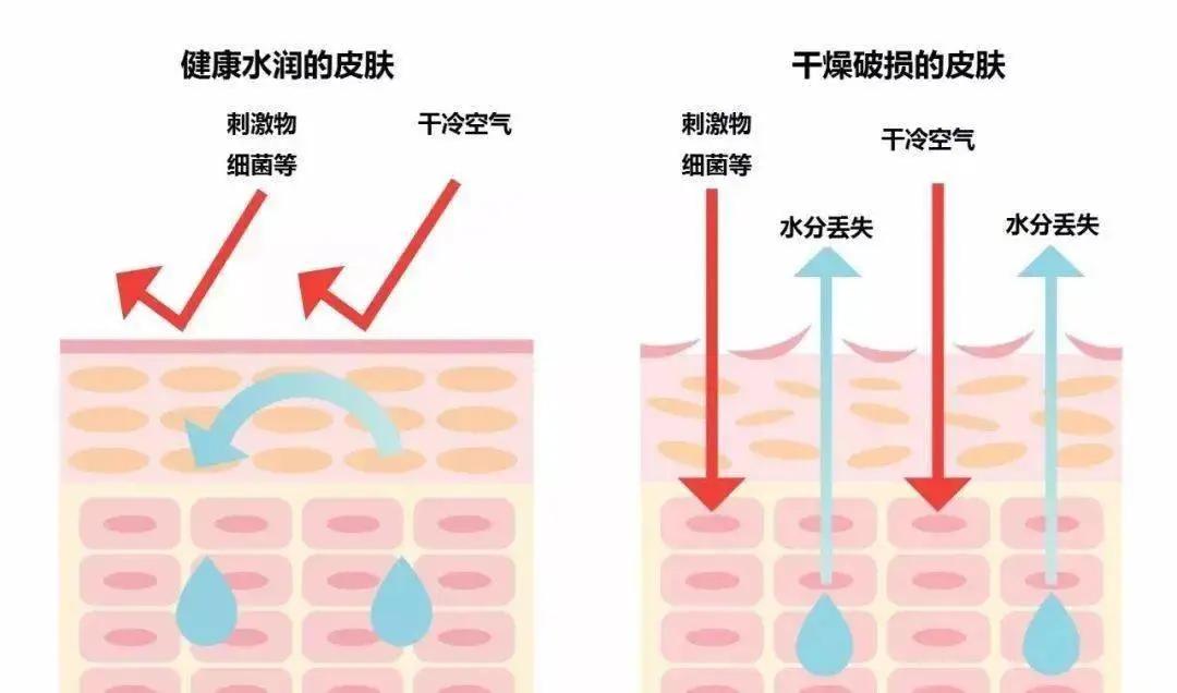 塑造美好的自己|痱子和湿疹护理不当，越治越重，别再傻傻分不清楚