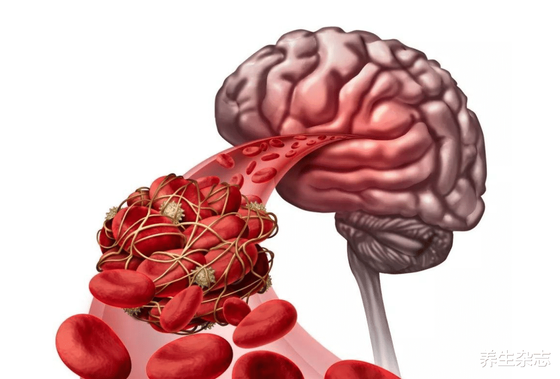 山楂|血管“刮油机”已公布，不是山楂，平时敞开吃，隔天一通到底！