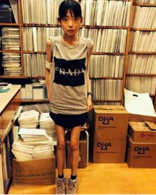 豪门|因丈夫3个字摘掉肠胃，嫁入豪门8年瘦到44斤，伍智恒经历了什么