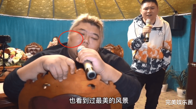 穿衣搭配 大胃王胖猴仔节食减肥10天，一顿回到解放前，脸部已出现“黑斑”