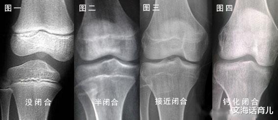 文海话育儿|初三男生身高定格在158cm，吃得好等于长得高？这些“智商税”别再交了