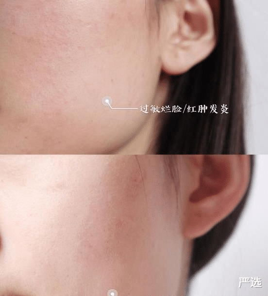 严选|张馨予晒出“自用”面霜，价格便宜不输兰蔻，李佳琦：大牌平替品