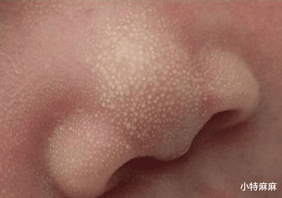 小特麻麻|新生儿很正常的8种生理现象，新手爸妈要知道