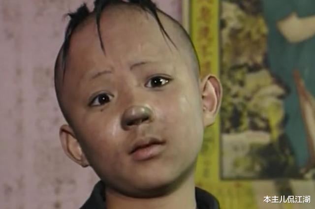 孟智超|“三毛”34岁了！8岁爆火，14岁谢顶，植发挨300多针，如今变帅哥