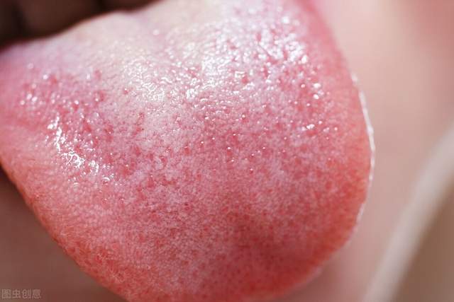 南瓜|漫谈中医:如何看舌苔辨别半表半里证