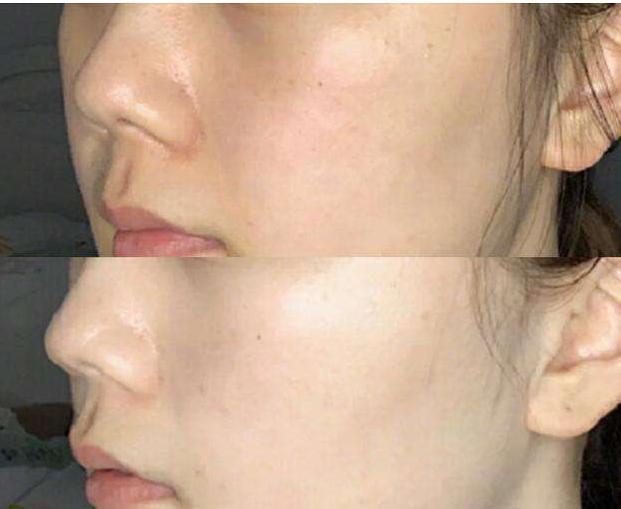 明星 长期使用精华液，三年后皮肤会变成什么样，说出来你或许不信