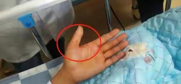 午美聊健康体态 警惕！清洗猪肉一个操作，可患上猪链球菌脑膜炎！严重可致命！
