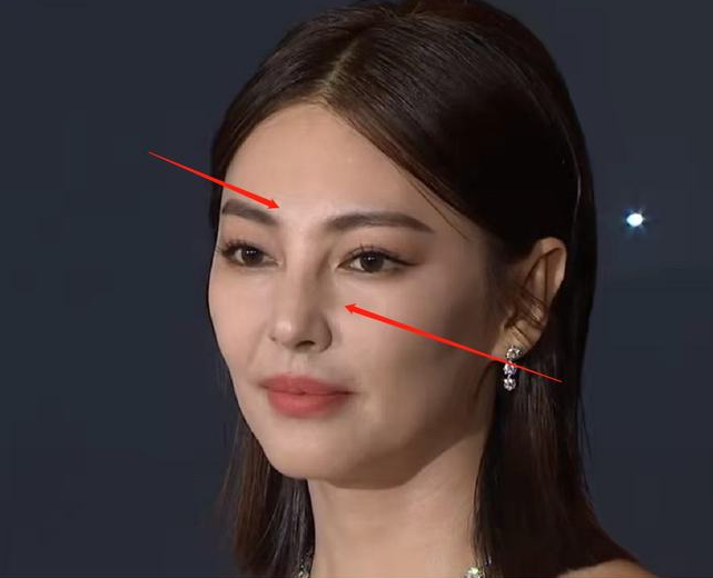 张雨绮|张雨绮红毯状态引热议，面部僵硬医美痕迹明显，网友直呼没认出来