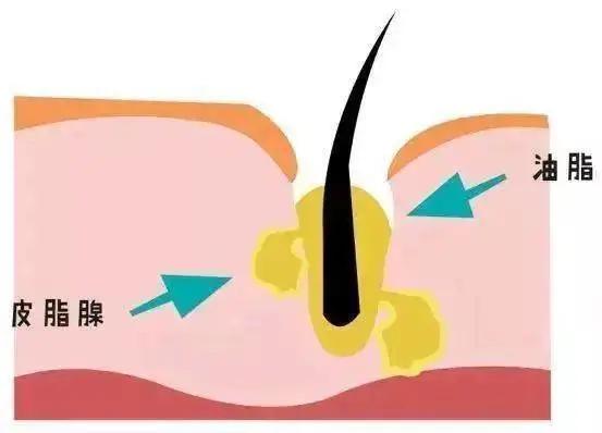 护肤|夏季控油误区你知道多少?你得学会拒绝“油腻”~