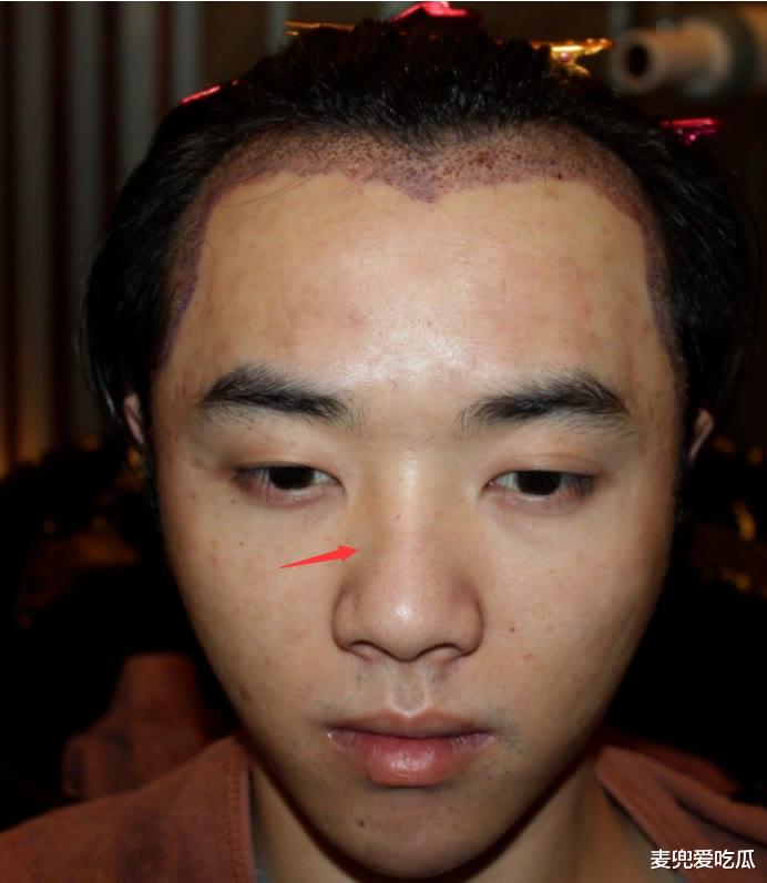 华晨宇|华晨宇表情管理失败？笑起来面部崩塌，被质疑整容失败