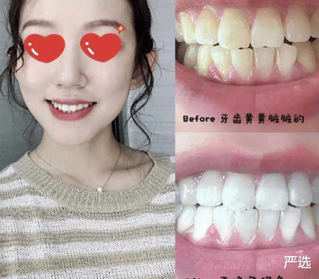 时尚好物官 “牙结石”别再用手抠，教你一招，脏东西自己往下掉了!