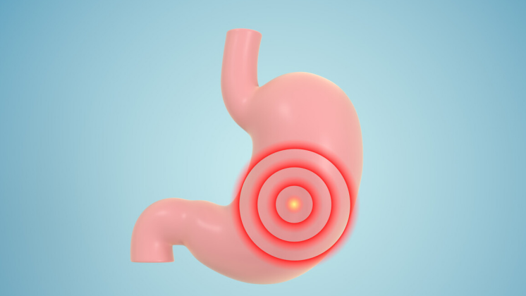 |若想胃好，日常坚持“3忌口”，或能帮助胃部越来越健康