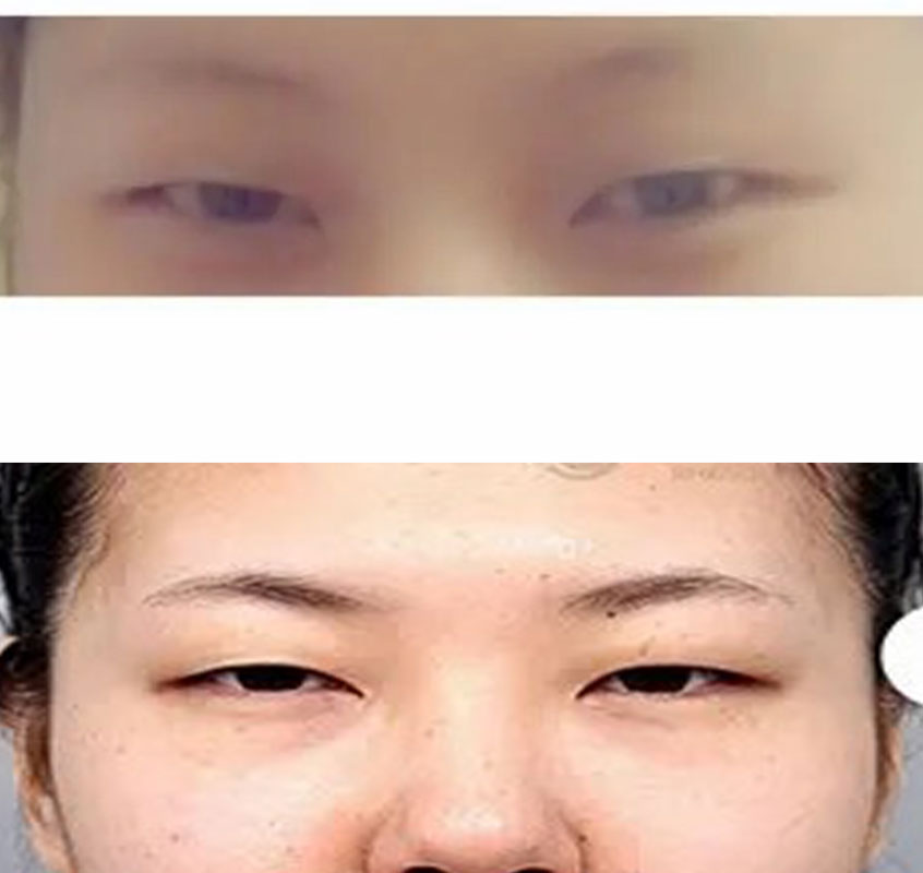 锡纸烫|其他眼型盘点：是不是在五大标准眼型中没有像自己这样的？进来这里看看吧