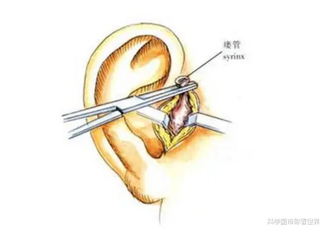 为何说人是由鱼进化而来?耳朵旁那个流出臭臭液体的小洞就是答案