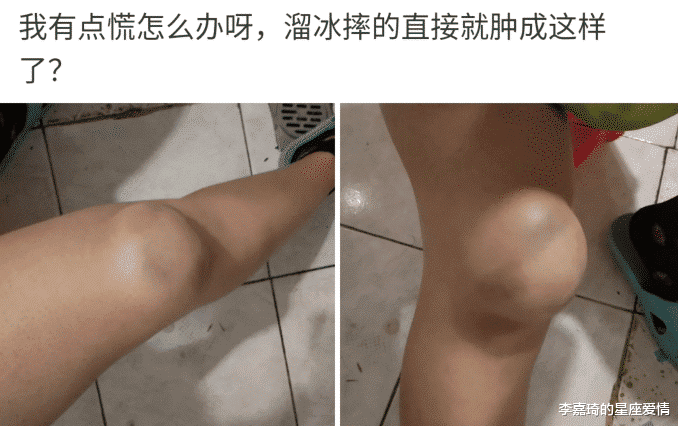 李嘉琦的星座爱情|“有点慌，溜冰摔的膝盖鼓起一个大包...”哈哈哈专业团队可以抬走了