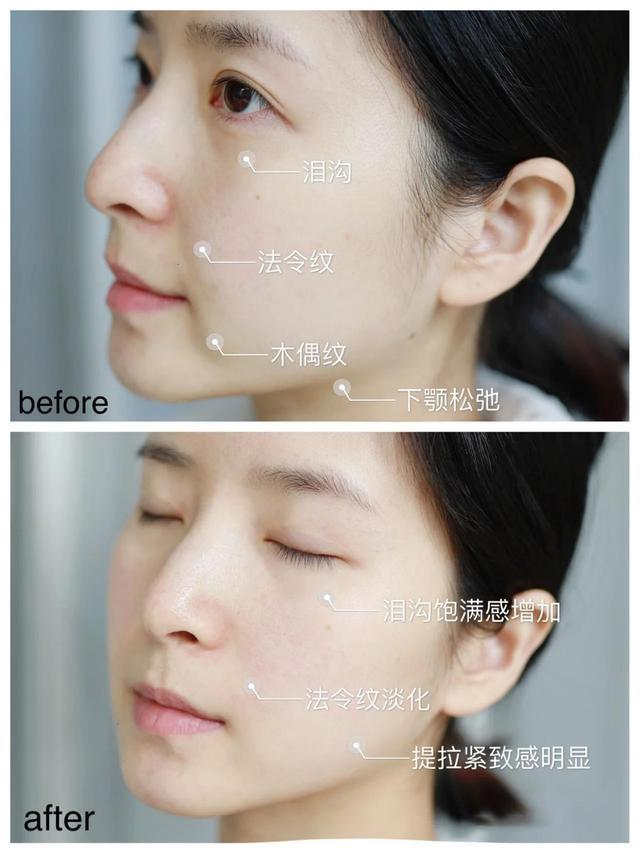 面霜 李佳琦分享的面霜被赞，用后肌肤犹如剥壳鸡蛋，价格却只需几十元！